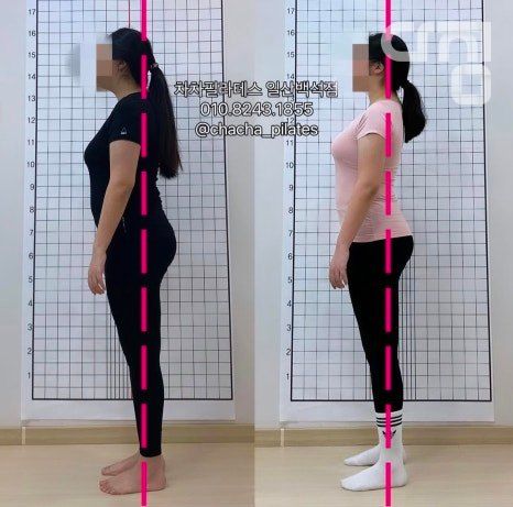 디테일 사진